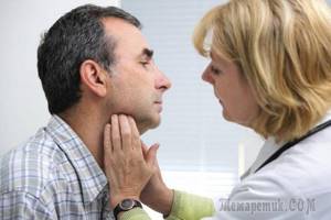 Симптоматика зоба щитовидной железы и способы лечения