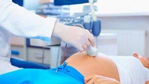 воспаление аппендицита у беременных