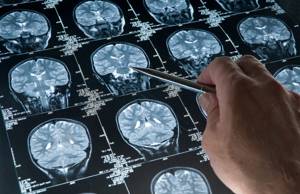 МРТ костных структур и головного мозга
