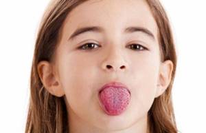 Скарлатина у детей: причины и симптомы, лечение и профилактика заболевания