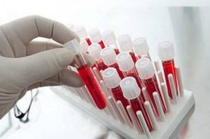 Скрининг 1 триместра — расшифровка результатов. Биохимический скрининг крови и УЗИ обследование беременной
