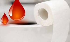 Скрытая кровь в кале у женщины: причины появления крови при дефекации без боли