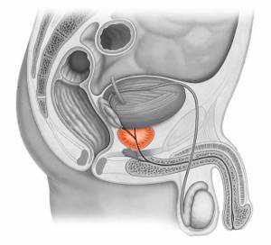 Простата находится близко от прямой кишки