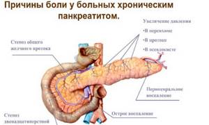 Повышенное давление в протоках поджелудочной приводит к застою пищеварительного сока, который со временем нарушает структуру органа.
