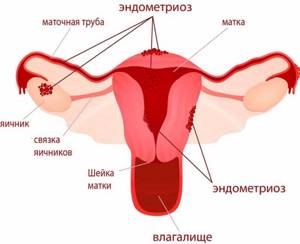 Транексам. Инструкция по применению при маточных кровотечениях, беременности, обильных месячных. Аналоги, цена