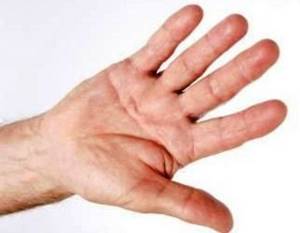 Тремор рук, что это такое и как избавиться? — причины и лечение тремора