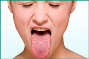 Побочный эффект: сухость во рту
