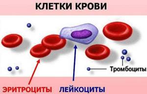 Тромбоцитопения – что это такое, чем грозит снижение тромбоцитов, и как повысить их уровень? - MyMedNews.ru