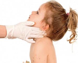 Виды кожных высыпаний у детей: фото сыпи на груди, спине и по всему телу с пояснениями