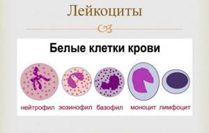Виды лейкоцитов в крови, их нормы, повышенные и пониженные значения