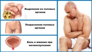 Симптомы венерологических заболеваний у мужчин. Фото. Ощущения и лечение. Признаки и клинические рекомендации
