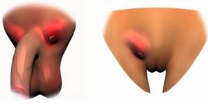 Симптомы венерологических заболеваний у мужчин. Фото. Ощущения и лечение. Признаки и клинические рекомендации