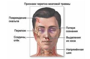 Симптомы гематомы внутри черепа
