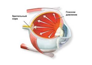 При повышенном ВГД возможно повреждение зрительного нерва