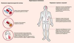 Все о гипертонической болезни: виды, симптомы, осложнения и лечение