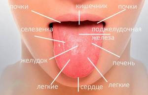 Внутренние болезни и налет на языке