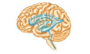 Гидроцефалия головного мозга